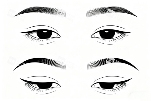 割雙眼皮成果展示 割雙眼皮成果展示