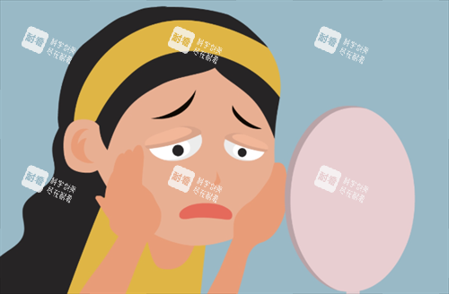 雙眼皮松弛 雙眼皮松弛