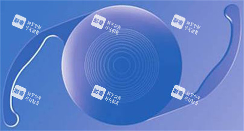 白內(nèi)障晶體示意圖展示