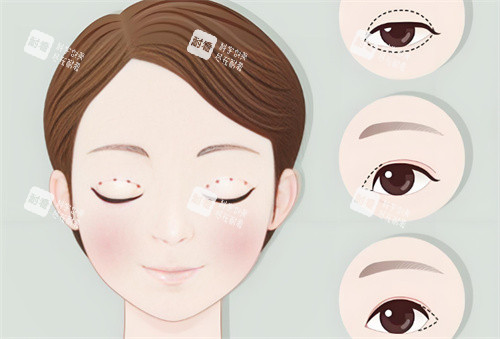 鄭大一附院整形手術(shù)收費價格表:雙眼皮6000元起、隆胸2萬元起、拉皮1.5萬元起