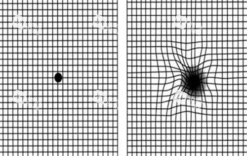 正常視覺(jué)和黃斑病變視覺(jué)
