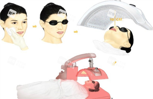 光動(dòng)力治療黃斑眼病過(guò)程圖解