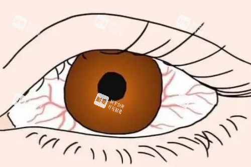 眼睛充血卡通圖 眼睛充血卡通圖