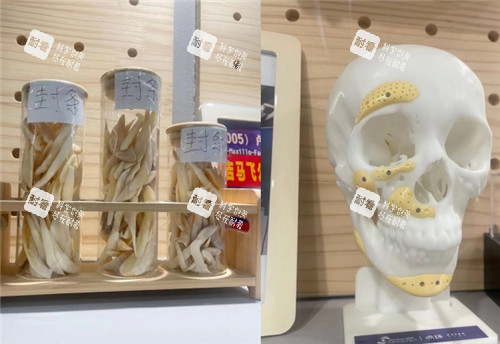 重慶松山醫(yī)院截骨整理圖 重慶松山醫(yī)院截骨整理圖