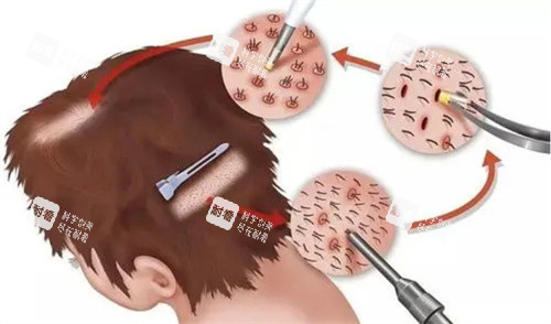 廣州倍生植發(fā)醫(yī)院地址在哪里的？越秀區(qū)東風(fēng)東路754號(hào)之七三樓是詳細(xì)地址哦！