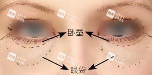 眼周組織圖 眼周組織圖
