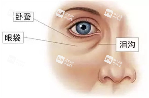 眼部結(jié)構(gòu)示意圖 眼部結(jié)構(gòu)示意圖