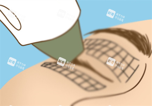 眼部熱瑪吉 眼部熱瑪吉