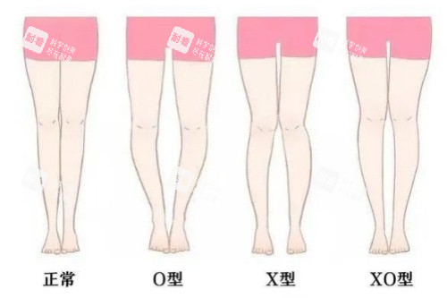 腿型卡通對(duì)比圖