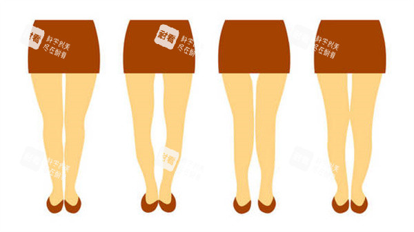 腿型矯正術(shù)