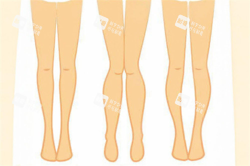 腿型對(duì)比