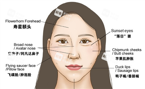 劉文閣面部饅化修復(fù)有多絕?親測(cè)者說:自然到像換回原生臉