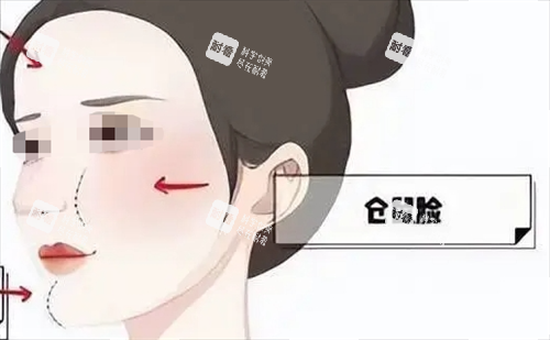 玻尿酸后饅化現(xiàn)象動畫展示 玻尿酸后饅化現(xiàn)象動畫展示