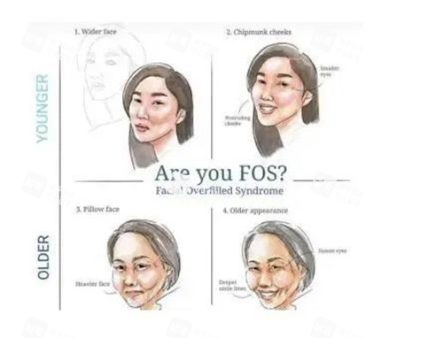 饅化臉示意圖 饅化臉示意圖