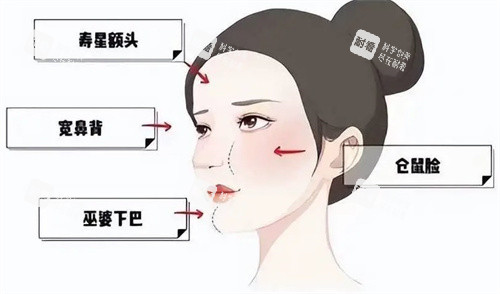 北京王闊遠治療饅化臉怎么樣？治療饅化臉技術成熟，精細化修復自然無痕
