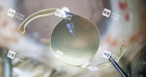 三焦點人工晶體