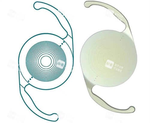 三焦點人工晶體圖片