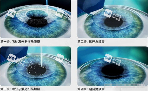 北京同仁眼科醫(yī)院24小時在線服務，詢問問診預約掛號全天候便捷