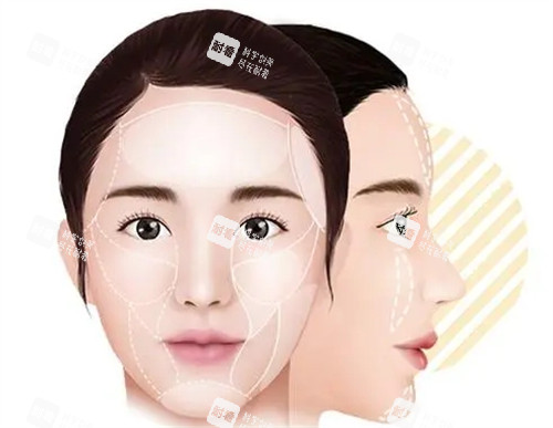 饅化臉需要修復(fù)部位圖解 饅化臉需要修復(fù)部位圖解