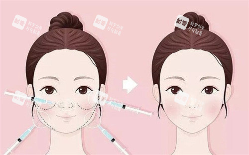 王闊遠醫(yī)生怎么預約？王闊遠醫(yī)生支持電話、線上、到院多渠道預約