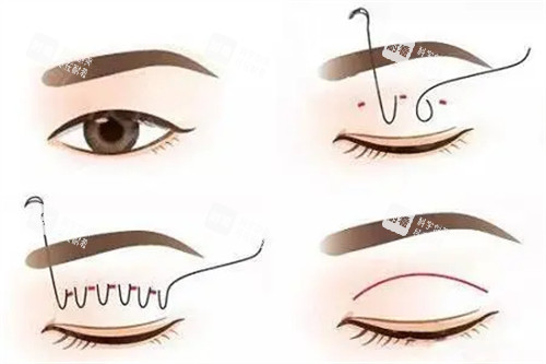 三點(diǎn)過程示意 三點(diǎn)過程示意