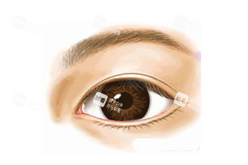 真實(shí)雙眼皮示意圖 真實(shí)雙眼皮示意圖