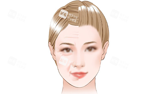 面部抗衰老的意義