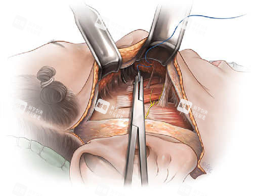 SMAS筋膜層圖示 SMAS筋膜層圖示