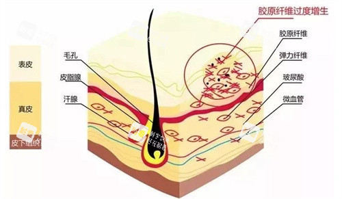 廣元去疤痕好的醫(yī)院推薦:這三家寶藏機(jī)構(gòu)讓你真正告別疤痕夢魘,重獲無瑕肌膚自信