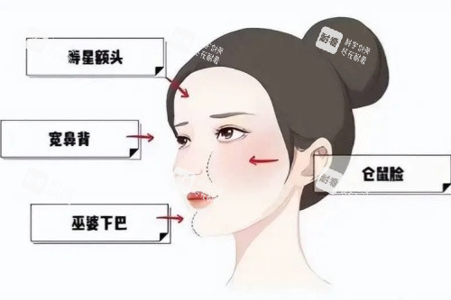 面部饅化卡通圖