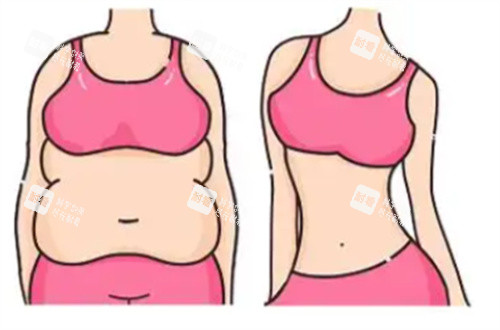 吸脂前后對(duì)比圖展示