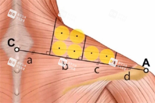 直角肩注射點位細節(jié)剖析