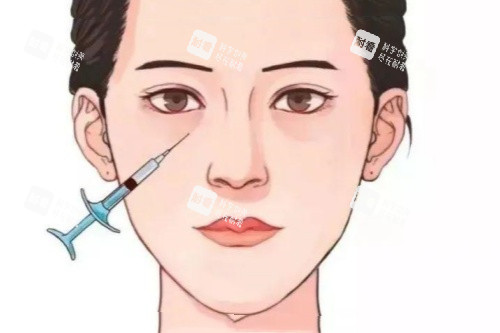 眼部注射卡通圖