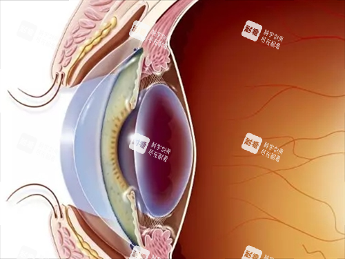 割眼角膜手術(shù)眼部側(cè)面透視圖