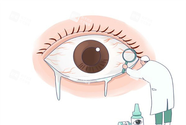眼角膜治療卡通圖
