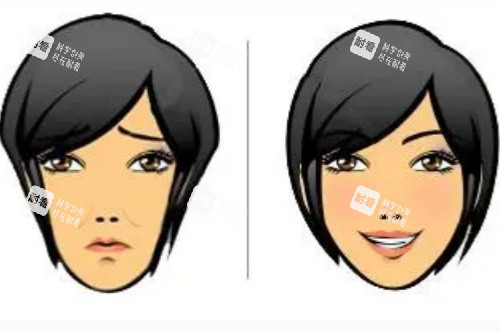 蘋果肌填充對比圖