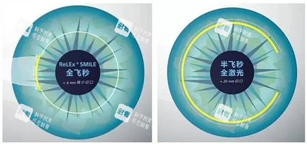 全飛秒半飛秒激光照片 全飛秒半飛秒激光照片