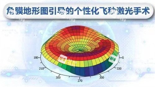 個(gè)性化飛秒激光手術(shù) 個(gè)性化飛秒激光手術(shù)