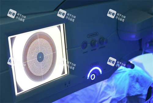 近視眼手術(shù) 近視眼手術(shù)