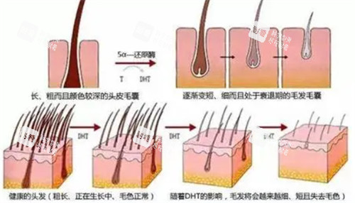 毛囊的不同健康情況